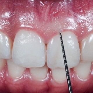 Parodontalna i oralna hirurgija
